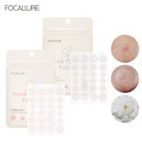 FOCALLURE 24PCS Day Night Use Tea Tree Extract Acne Removal Pimple Patch Hydrocolloid Transparent Invisible Acne Removal Sticker