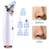 Facial Blackhead Pore Cleaner Remove Blackheads Grease Beauty Equipment Black Spots Pore Cleaner Machine Beauty Kit Tools Hot